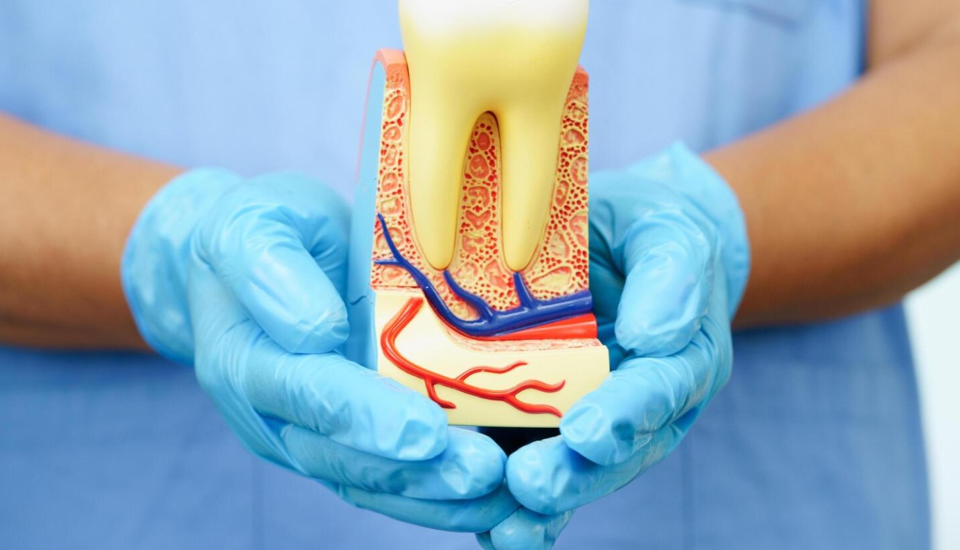 Root Canal Treatment
