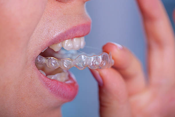 Smile Solutions